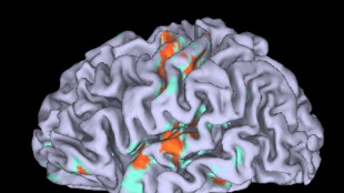 Il tempo si dilata quando il cervello apprende un nuovo movimento