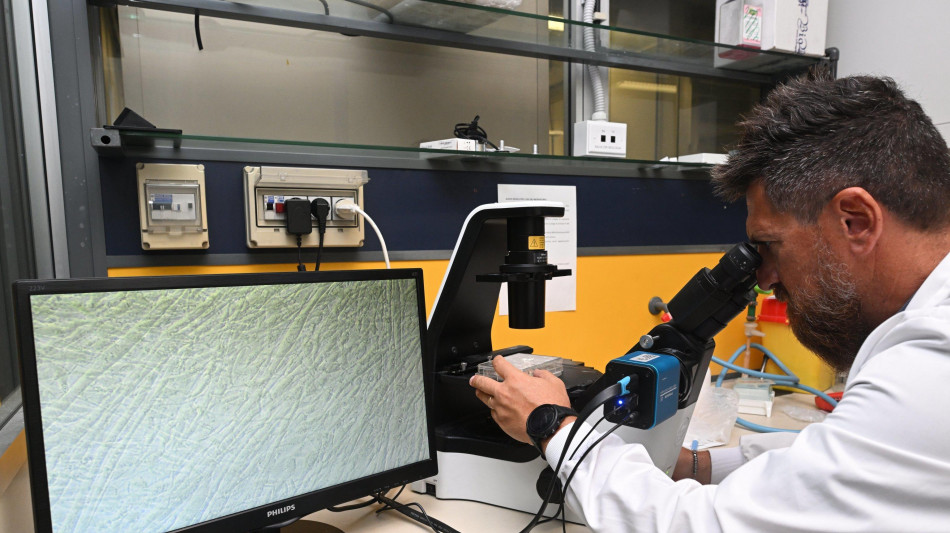 Svelato come la sclerosi multipla uccide i neuroni