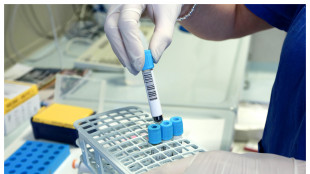Dall'Rna una nuova speranza per diverse malattie genetiche