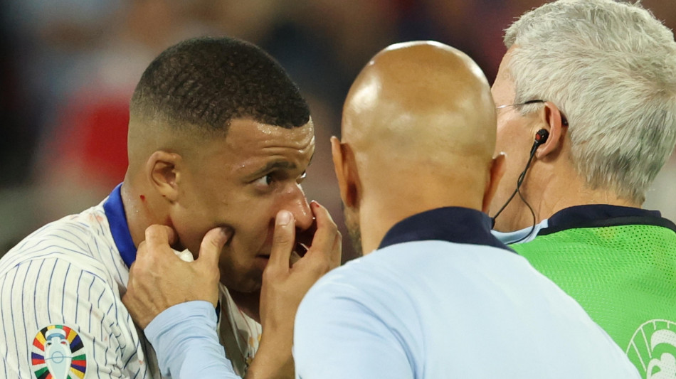 Euro 24: Francia, frattura al naso per Mbapp&eacute;